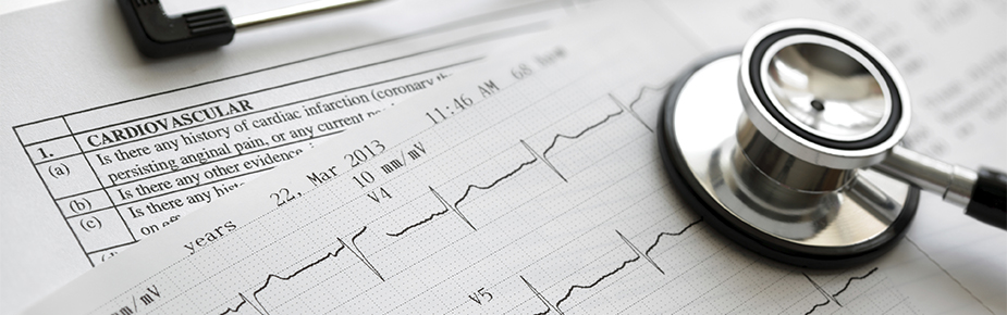 Stethoscope lying on an ECG graph